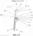 Fig. 04 - DIRECT-VISION ABORTION UTERINE CURETTAGE DEVICE AND SYSTEM