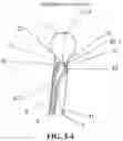 Fig. 12 - DIRECT-VISION ABORTION UTERINE CURETTAGE DEVICE AND SYSTEM