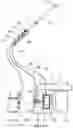 Fig. 15 - DIRECT-VISION ABORTION UTERINE CURETTAGE DEVICE AND SYSTEM