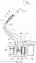 Fig. 16 - DIRECT-VISION ABORTION UTERINE CURETTAGE DEVICE AND SYSTEM