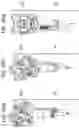 Fig. 22 - DEVICES AND METHODS FOR COSMETIC SKIN RESURFACING