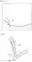 Fig. 09 - Method for forming access route to bile duct and treatment method