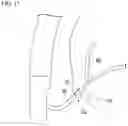 Fig. 12 - Method for forming access route to bile duct and treatment method