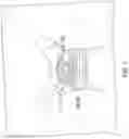 Fig. 05 - System and method for paraurethral support restoration to treat stress incontinence
