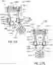 Fig. 51 - Pivotal bone anchor assembly having first and second split rings and an insert with post-placement tool deployment