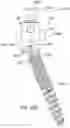 Fig. 63 - Pivotal bone anchor assembly having first and second split rings and an insert with post-placement tool deployment