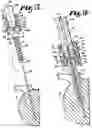 Fig. 10 - Pivotal bone anchor assembly with interchangeable closures