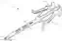 Fig. 01 - Surgical instrument and method
