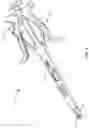 Fig. 02 - Surgical instrument and method