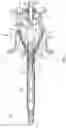 Fig. 04 - Surgical instrument and method