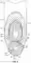 Fig. 06 - Implant System for Bone Fixation