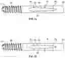 Fig. 07 - Implant System for Bone Fixation