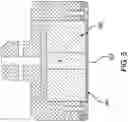 Fig. 06 - SYSTEMS AND METHODS FOR A SMART, IMPLANTABLE CRANIO-MAXILLO-FACIAL DISTRACTOR