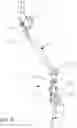 Fig. 06 - Bone clamp