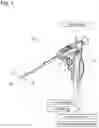 Fig. 02 - Systems and methods for treating the bladder with condensable vapor