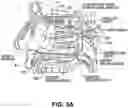 Fig. 04 - Systems and methods for therapeutic nasal neuromodulation