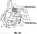 Fig. 05 - Systems and methods for therapeutic nasal neuromodulation