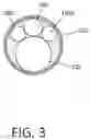 Fig. 04 - Tissue extraction devices and methods