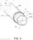 Fig. 06 - Tissue extraction devices and methods