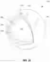 Fig. 11 - CAVITARY TISSUE ABLATION