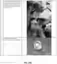 Fig. 25 - CAVITARY TISSUE ABLATION