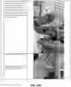 Fig. 26 - CAVITARY TISSUE ABLATION