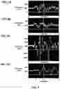 Fig. 04 - Device and method for in vivo detection of clots within circulatory vessels