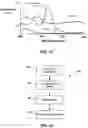 Fig. 14 - Device and method for in vivo detection of clots within circulatory vessels