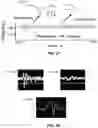 Fig. 18 - Device and method for in vivo detection of clots within circulatory vessels