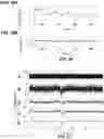 Fig. 20 - Device and method for in vivo detection of clots within circulatory vessels