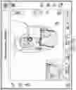 Fig. 41 - METHODS FOR IMPROVED SURGICAL PLANNING USING MACHINE LEARNING AND DEVICES THEREOF