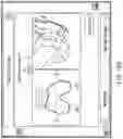 Fig. 43 - METHODS FOR IMPROVED SURGICAL PLANNING USING MACHINE LEARNING AND DEVICES THEREOF