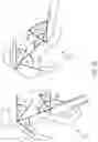Fig. 47 - METHODS FOR IMPROVED SURGICAL PLANNING USING MACHINE LEARNING AND DEVICES THEREOF