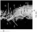 Fig. 48 - METHODS FOR IMPROVED SURGICAL PLANNING USING MACHINE LEARNING AND DEVICES THEREOF