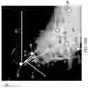 Fig. 49 - METHODS FOR IMPROVED SURGICAL PLANNING USING MACHINE LEARNING AND DEVICES THEREOF
