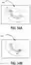 Fig. 63 - METHODS FOR IMPROVED SURGICAL PLANNING USING MACHINE LEARNING AND DEVICES THEREOF