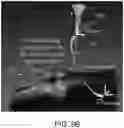 Fig. 16 - ULTRASOUND BASED MULTIPLE BONE REGISTRATION SURGICAL SYSTEMS AND METHODS OF USE IN COMPUTER-ASSISTED SURGERY