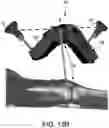 Fig. 25 - ULTRASOUND BASED MULTIPLE BONE REGISTRATION SURGICAL SYSTEMS AND METHODS OF USE IN COMPUTER-ASSISTED SURGERY
