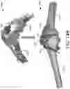 Fig. 27 - ULTRASOUND BASED MULTIPLE BONE REGISTRATION SURGICAL SYSTEMS AND METHODS OF USE IN COMPUTER-ASSISTED SURGERY