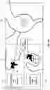 Fig. 13 - TOOL FOR INSERTING AN IMPLANT AND METHOD OF USING SAME
