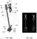 Fig. 17 - Robotic navigational system