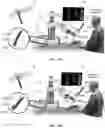Fig. 29 - Robotic navigational system