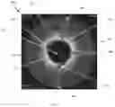 Fig. 04 - Occlusion-crossing devices, atherectomy devices, and imaging