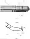 Fig. 06 - Occlusion-crossing devices, atherectomy devices, and imaging