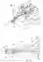 Fig. 04 - ROBOTIC CATHETER SYSTEM ADAPTOR