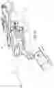 Fig. 11 - ROBOTIC CATHETER SYSTEM ADAPTOR