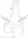 Fig. 05 - SYSTEMS AND METHODS ASSOCIATED WITH PASSIVE ROBOTIC ARM