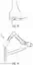 Fig. 29 - SYSTEMS AND METHODS ASSOCIATED WITH PASSIVE ROBOTIC ARM
