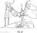 Fig. 34 - SYSTEMS AND METHODS ASSOCIATED WITH PASSIVE ROBOTIC ARM