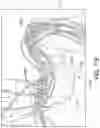 Fig. 26 - DEVICES, SYSTEMS, AND METHODS FOR MAINTAINING A STERILE SURGICAL FIELD